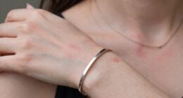 identify accessory related issues